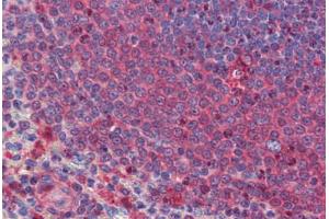 Human Spleen: Formalin-Fixed, Paraffin-Embedded (FFPE) (DACT2 antibody  (N-Term))