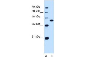 SLC14A1 antibody used at 0. (SLC14A1 antibody  (C-Term))