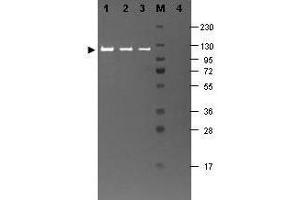 Western blotting using  Fluorescein conjugated anti-b-Galactosidase antibody shows a band at ~117 kDa (lanes 1 - 3) corresponding to 60 ng, 30 ng and 15 ng, respectively of b-Gal present in partially purified preparations (arrowhead). (GLB1 antibody)