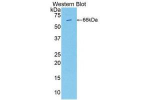 Western Blotting (WB) image for anti-Integrin beta 2 (ITGB2) (AA 451-627) antibody (ABIN1859503) (Integrin beta 2 antibody  (AA 451-627))