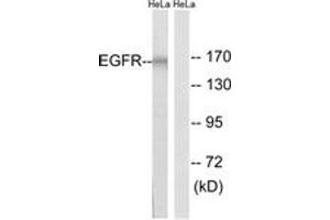 Western Blotting (WB) image for anti-Epidermal Growth Factor Receptor (EGFR) (AA 991-1040) antibody (ABIN2889085) (EGFR antibody  (AA 991-1040))