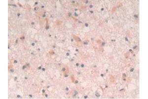 Immunohistochemistry (IHC) image for anti-Interleukin 4 (IL4) (AA 25-153) antibody (ABIN7445483)
