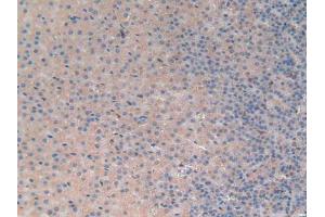 Immunohistochemistry (IHC) image for anti-Interferon alpha (IFNA) (AA 24-192) antibody (ABIN1078210)