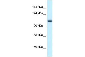 Western Blot showing Mcm10 antibody used at a concentration of 1. (MCM10 antibody  (N-Term))