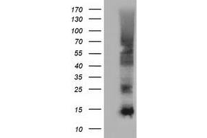 HEK293T cells were transfected with the pCMV6-ENTRY control (Left lane) or pCMV6-ENTRY FSHB (Right lane) cDNA for 48 hrs and lysed. (FSHB antibody)