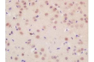 Formalin-fixed and paraffin embedded mouse brain labeled with Rabbit Anti-FLRT3 Polyclonal Antibody, Unconjugated  at 1:200 followed by conjugation to the secondary antibody and DAB staining (FLRT3 antibody  (AA 415-490))