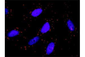 Proximity Ligation Analysis of protein-protein interactions between TRAF4 and TRAF6. (TRAF4 antibody  (AA 1-470))