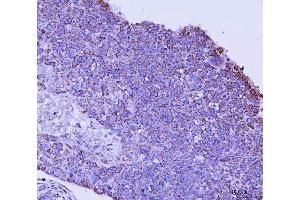 IHC analysis of TFEB using anti-TFEB antibody (ABIN7600648). (TFEB antibody  (AA 214-326))
