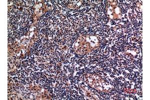 Immunohistochemistry (IHC) analysis of paraffin-embedded Human Lymph Gland, antibody was diluted at 1:100. (Cytokeratin 19 antibody  (C-Term))