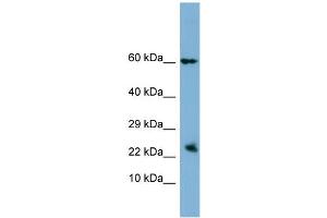 Host: Rabbit Target Name: HBEGF Sample Type: PANC1 Whole Cell lysates Antibody Dilution: 1. (HBEGF antibody  (N-Term))