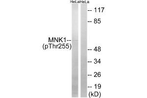 Western blot analysis of extracts from HeLa cells, treated with Adriamycin (0. (MKNK1 antibody  (pThr255))