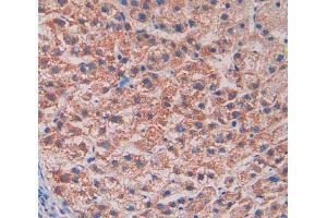 Used in DAB staining on fromalin fixed paraffin- embedded liver tissue (Reelin antibody  (AA 3142-3460))