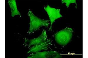 Immunofluorescence of purified MaxPab antibody to ZYX on HeLa cell. (ZYX antibody  (AA 1-572))