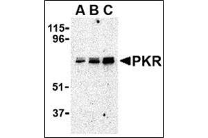 Western blot analysis of PKR in A431 whole cell lysate with this product at (A) 0. (EIF2AK2 antibody  (C-Term))