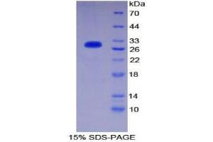 SDS-PAGE (SDS) image for CD1d Molecule (CD1D) (AA 56-271) protein (His tag) (ABIN2124367)