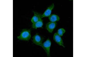 IF analysis of ADH1A using anti-ADH1A antibody (ABIN4886427).