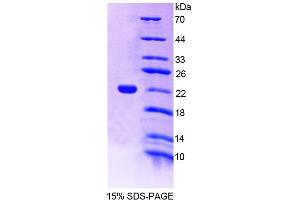 SDS-PAGE analysis of Mouse a4GALT Protein. (A4GALT Protein)