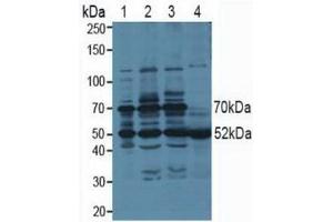 Western blot analysis of (1) Human 293T cells, (2) Human HeLa cells, (3) Human HepG2 cells and (4) Human Saliva Tissue. (PSMC3 antibody  (AA 2-439))