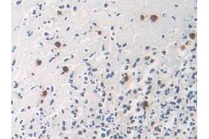 Immunohistochemistry (IHC) image for anti-Docking Protein 3 (DOK3) (AA 128-385) antibody (ABIN7443533)
