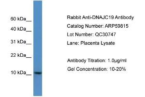 WB Suggested Anti-DNAJC19  Antibody Titration: 0. (DNAJC19 antibody  (C-Term))