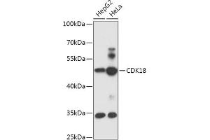 Western blot analysis of extracts of various cell lines, using CDK18 antibody (ABIN7266581) at 1:1000 dilution. (CDK18 antibody  (AA 373-474))