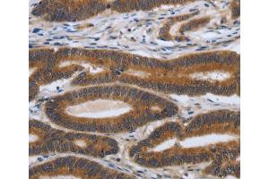 Immunohistochemistry (IHC) image for anti-Platelet Derived Growth Factor A (PDGFA) antibody (ABIN2426819)