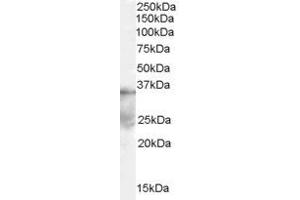 Western Blotting (WB) image for anti-Autophagy related 4A Cysteine Peptidase (ATG4A) (Middle Region) antibody (ABIN2787881) (ATG4A antibody  (Middle Region))