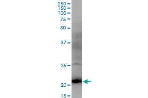 DR1 MaxPab polyclonal antibody. (DR1 antibody  (AA 1-176))