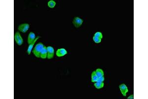 Immunofluorescent analysis of MCF-7 cells using ABIN7162688 at dilution of 1:100 and Alexa Fluor 488-congugated AffiniPure Goat Anti-Rabbit IgG(H+L) (PNPLA1 antibody  (AA 101-300))