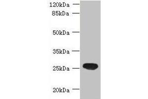 Western blot All lanes: ENKD1 antibody at 7 μg/mL + Mouse brain tissue Secondary Goat polyclonal to rabbit IgG at 1/10000 dilution Predicted band size: 39, 26 kDa Observed band size: 26 kDa (ENKD1 antibody  (AA 1-346))