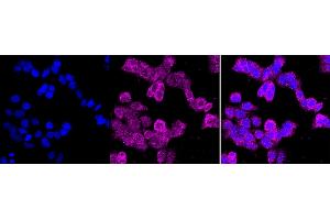 Immunocytochemical staining of HAP-1 cells with CD10 antibody (ABIN7799366), 1:1,000). (Recombinant MME antibody)