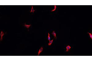 Immunofluorescence (fixed cells) (IF/ICC) image for anti-Heat Shock Protein 90kDa alpha (Cytosolic), Class A Member 1 (HSP90AA1) (C-Term) antibody (ABIN6262402)