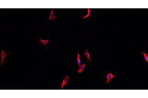 ABIN6268915 staining HeLa cells by IF/ICC.