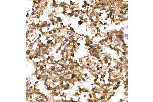 Immunohistochemistry of paraffin-embedded Human testicular seminoma using NY-ESO-1 Rabbit pAb (ABIN6131864, ABIN6143238, ABIN6143239 and ABIN6221674) at dilution of 1:200 (40x lens). (LIN28A antibody  (AA 142-209))