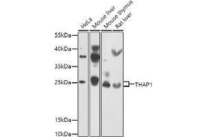 Western blot analysis of extracts of various cell lines, using TH antibody (ABIN6128823, ABIN6149105, ABIN6149106 and ABIN6223361) at 1:1000 dilution.