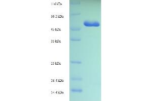 SDS-PAGE (SDS) image for Cyclin-Dependent Kinase 5 (CDK5) (AA 1-292), (full length) protein (His-SUMO Tag) (ABIN5709263) (CDK5 Protein (AA 1-292, full length) (His-SUMO Tag))