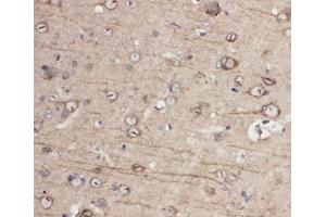 Immunohistochemistry (IHC) image for anti-Ephrin Type A Receptor 1 (EPHA1) (C-Term) antibody (ABIN3030829)