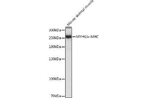 Western blot analysis of extracts of Mouse skeletal muscle, using MYH6/α-MHC Rabbit pAb (ABIN6129610, ABIN6144236, ABIN6144237 and ABIN6216792) at 1:3000 dilution. (MYH6 antibody  (AA 1-250))