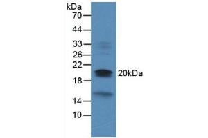Figure. (Dual Specificity Phosphatase 3 (DUSP3) (AA 2-185) antibody)