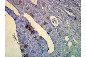 Image no. 1 for anti-Heat Shock Protein 70 (HSP70) (AA 436-503) antibody (ABIN466875) (HSP70 antibody  (AA 436-503))