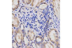Immunohistochemistry (IHC) image for anti-Adaptor-Related Protein Complex 2, alpha 2 Subunit (AP2A2) antibody (ABIN1876579)