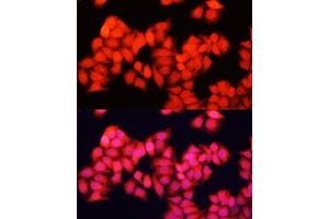 Immunofluorescence analysis of HeLa cells using ARAF antibody  at dilution of 1:100. (ARAF antibody  (AA 371-606))