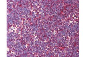 Anti-EOMES antibody IHC of human thymus. (EOMES antibody  (N-Term))