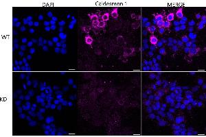 anti-Caldesmon 1 (CALD1) antibody