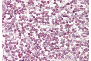 Rabbit Anti-TFCP2 antibody Catalog Number: ARP31073 Formalin Fixed Paraffin Embedded Tissue: Human Tonsil Primary antibody Concentration: 1:200 Secondary Antibody: Donkey anti-Rabbit-Cy3 Secondary Antibody Concentration: 1:200 Magnification: 20x Exposure Time: 0. (TFCP2 antibody  (N-Term))