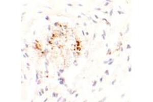Immunohistochemistry of LEMD3 in human colon tissue with LEMD3 antibody at 2. (LEMD3 antibody  (C-Term))