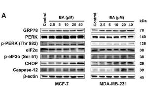 MCF-7 and MDA-MB-231 cells were treated with the indicated concentrations of BA for 24 h, and the protein levels of ER stress-associated signals were stimulated by BA in a dose-dependent manner, including GRP78, p-PERK/PERK, p-eIF2α/eIF2α, CHOP, and caspase-12. (EIF2S1 antibody  (N-Term))