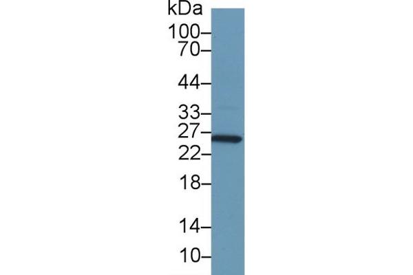 GSTA1 antibody  (AA 2-222)