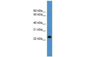 WB Suggested Anti-TNFSF4 Antibody Titration: 0. (TNFSF4 antibody  (Middle Region))