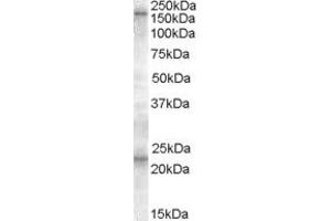 ABIN334499 (0. (ABCC8 antibody  (C-Term))